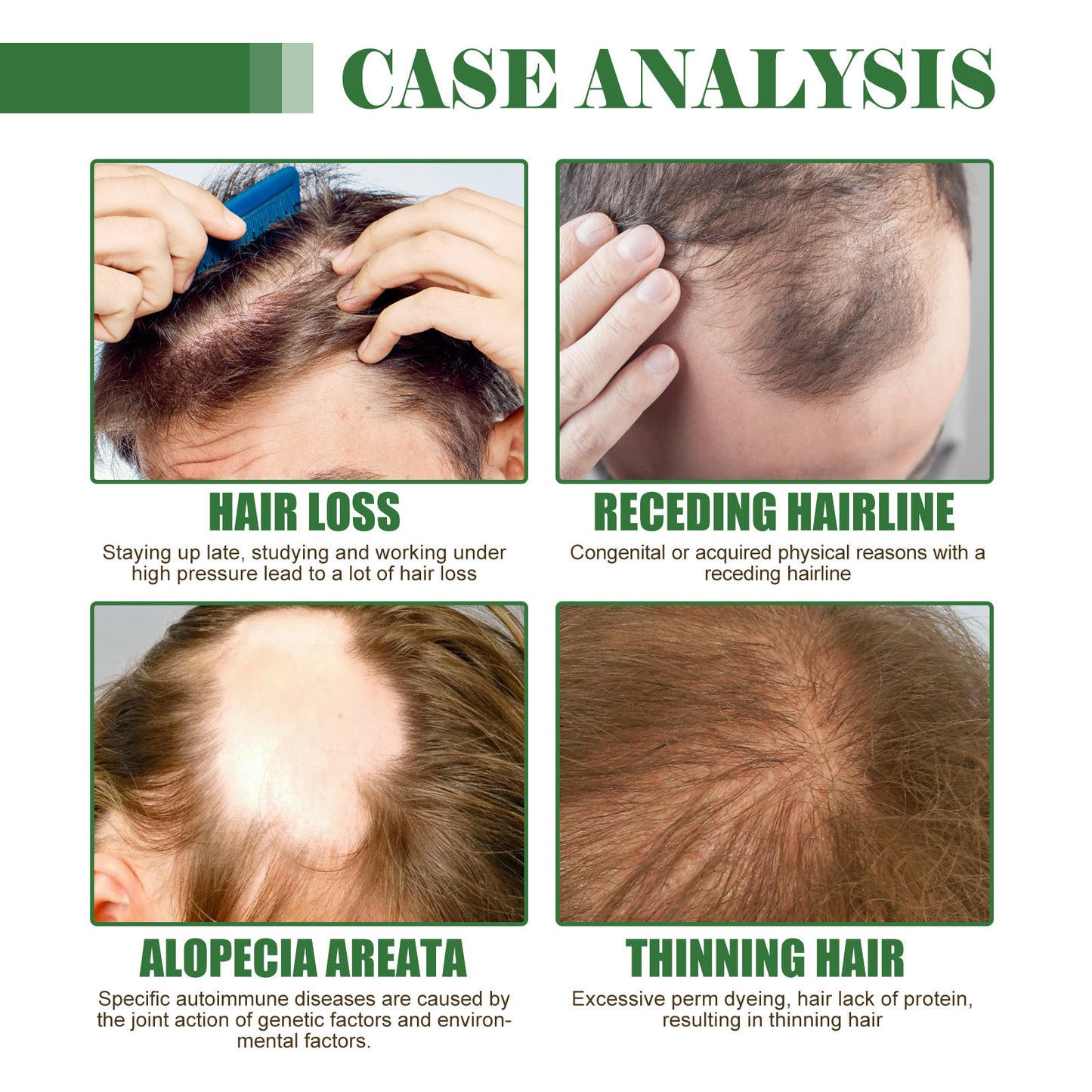 Dense Hair Oil Moisturizing Soft Hair Repair ShopWithASmile7.com