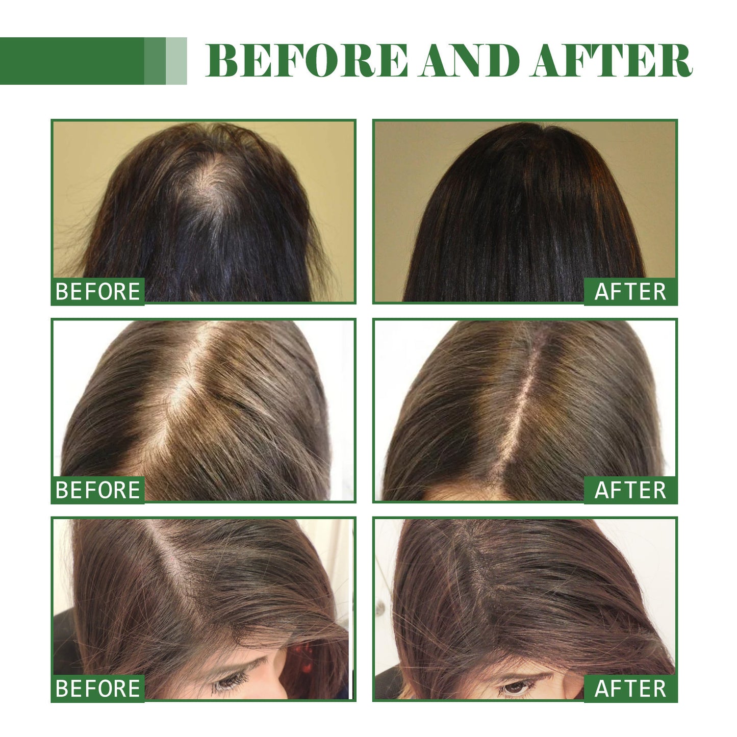 Dense Hair Oil Moisturizing Soft Hair Repair ShopWithASmile7.com