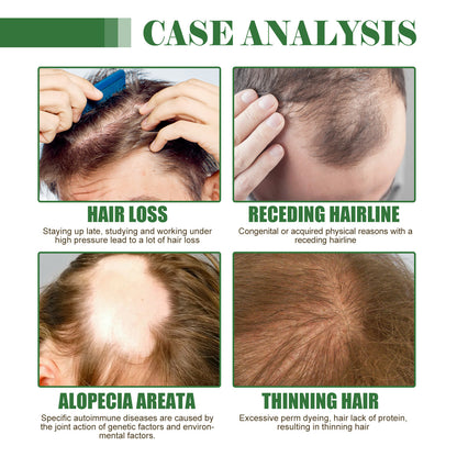 Dense Hair Oil Moisturizing Soft Hair Repair ShopWithASmile7.com